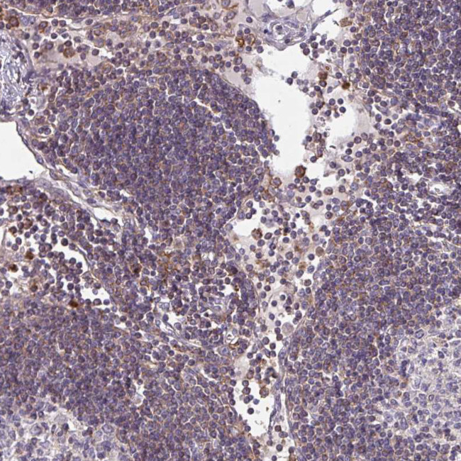 CSF3R Antibody in Immunohistochemistry (IHC)