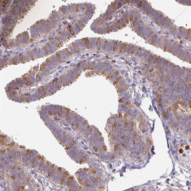 CSF3R Antibody in Immunohistochemistry (IHC)