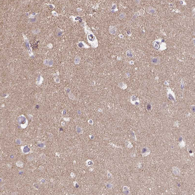 CSF3R Antibody in Immunohistochemistry (IHC)