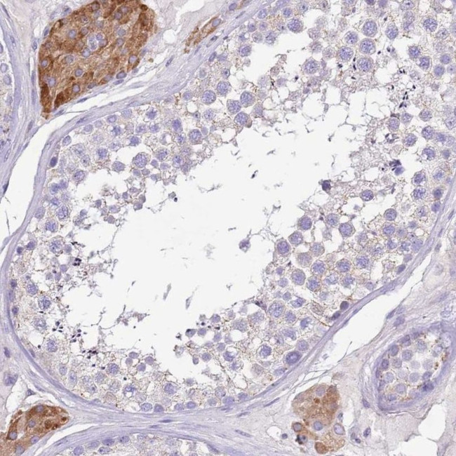 TDE1 Antibody in Immunohistochemistry (IHC)