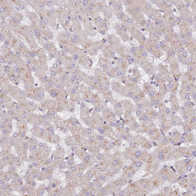 SPDL1 Antibody in Immunohistochemistry (IHC)