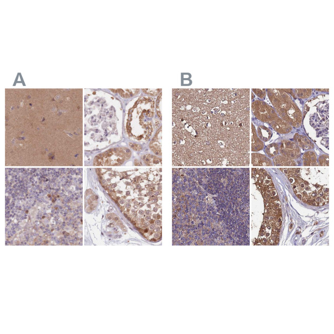 APOA1BP Antibody in Immunohistochemistry (IHC)