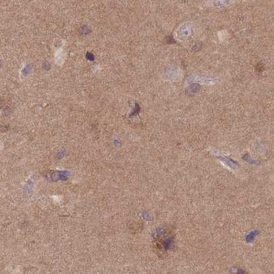 APOA1BP Antibody in Immunohistochemistry (IHC)