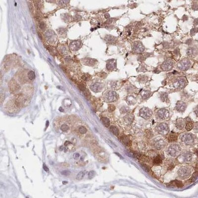 APOA1BP Antibody in Immunohistochemistry (IHC)