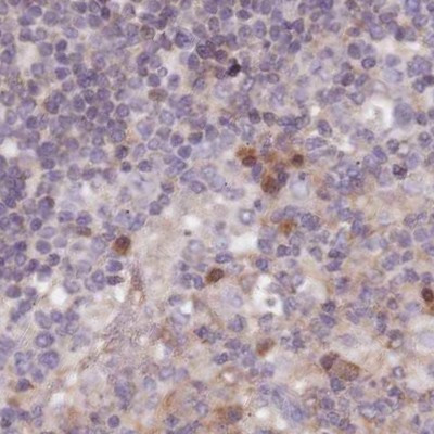 APOA1BP Antibody in Immunohistochemistry (IHC)