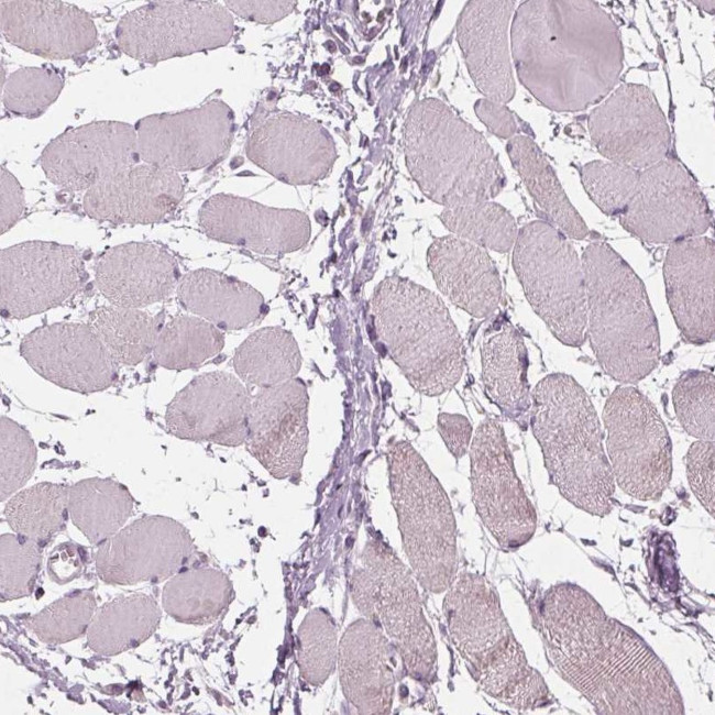 DAK Antibody in Immunohistochemistry (IHC)