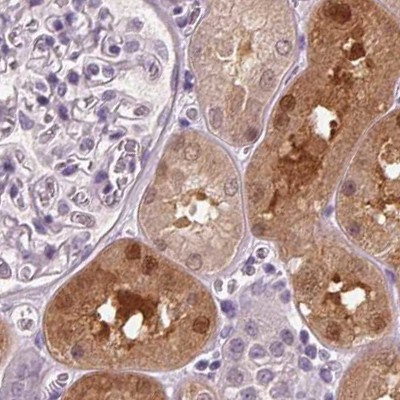 DAK Antibody in Immunohistochemistry (IHC)