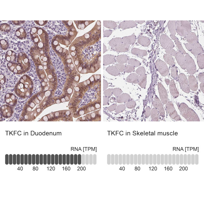 DAK Antibody