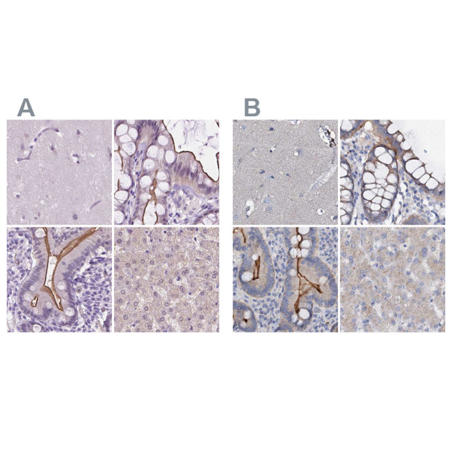 ACY3 Antibody in Immunohistochemistry (IHC)