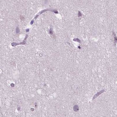 ACY3 Antibody in Immunohistochemistry (IHC)