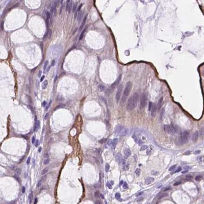 ACY3 Antibody in Immunohistochemistry (IHC)