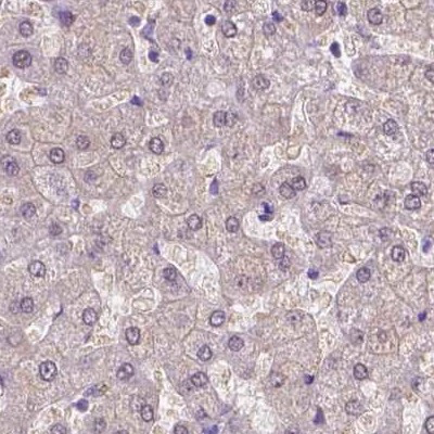 ACY3 Antibody in Immunohistochemistry (IHC)