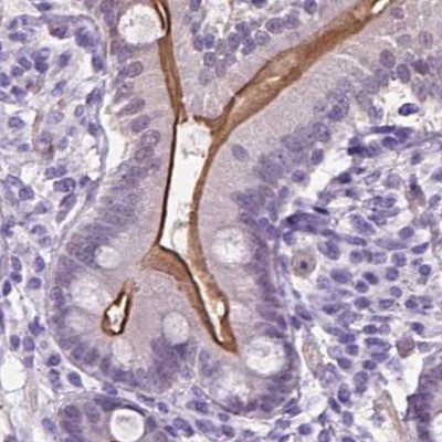 ACY3 Antibody in Immunohistochemistry (IHC)