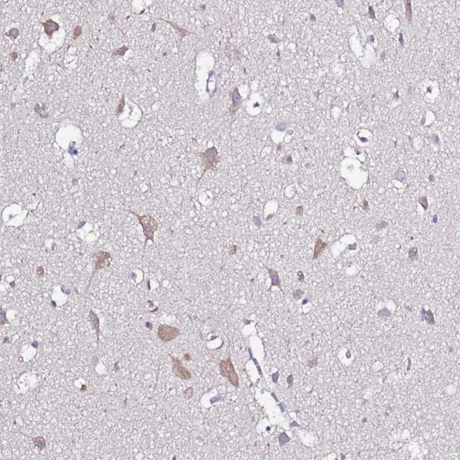 GLCE Antibody in Immunohistochemistry (IHC)