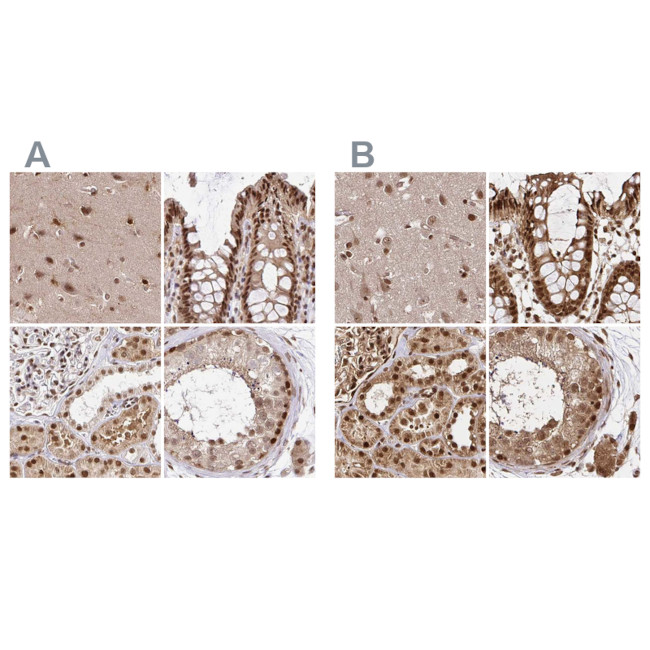 GLYR1 Antibody in Immunohistochemistry (IHC)