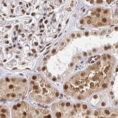 GLYR1 Antibody in Immunohistochemistry (IHC)