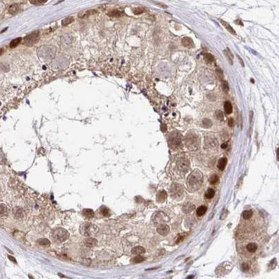 GLYR1 Antibody in Immunohistochemistry (IHC)