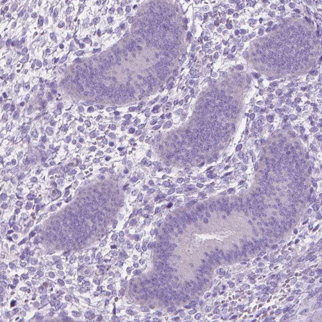 PDCL2 Antibody in Immunohistochemistry (IHC)