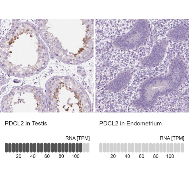 PDCL2 Antibody