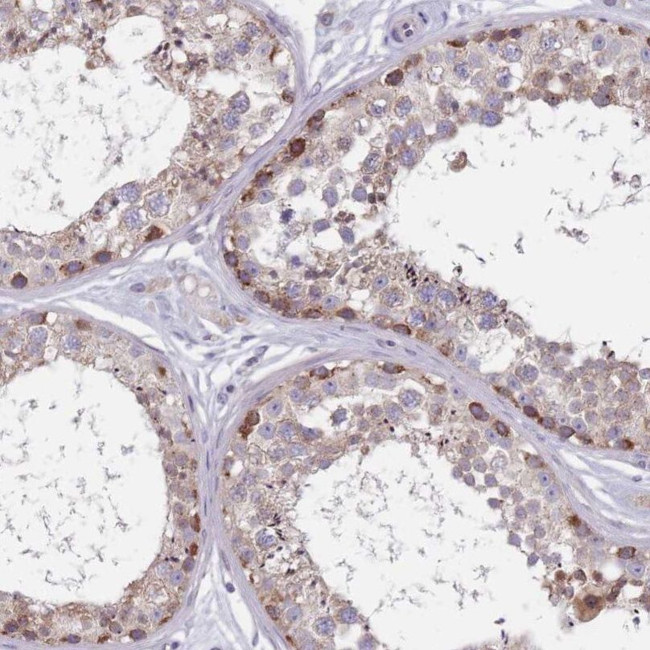 FTSJD1 Antibody in Immunohistochemistry (IHC)