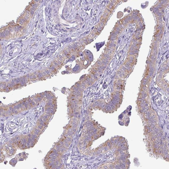 GALNT12 Antibody in Immunohistochemistry (IHC)