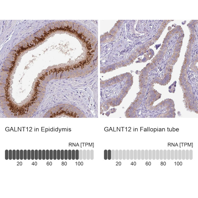 GALNT12 Antibody