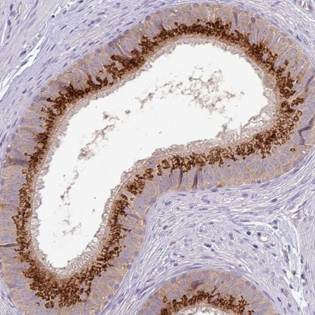 GALNT12 Antibody in Immunohistochemistry (IHC)