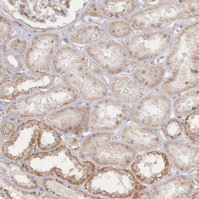 ZNF852 Antibody in Immunohistochemistry (IHC)