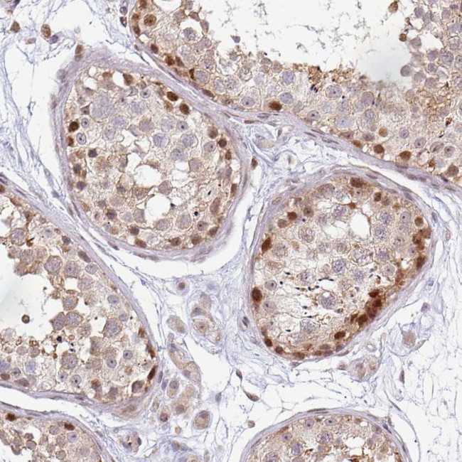 MAZ Antibody in Immunohistochemistry (IHC)