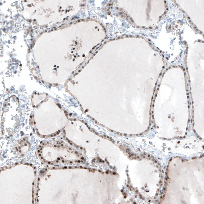 MAZ Antibody in Immunohistochemistry (IHC)