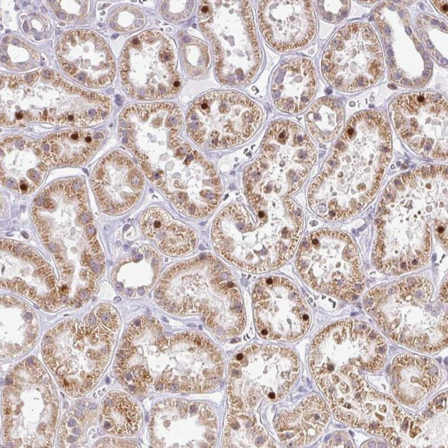 MAZ Antibody in Immunohistochemistry (IHC)