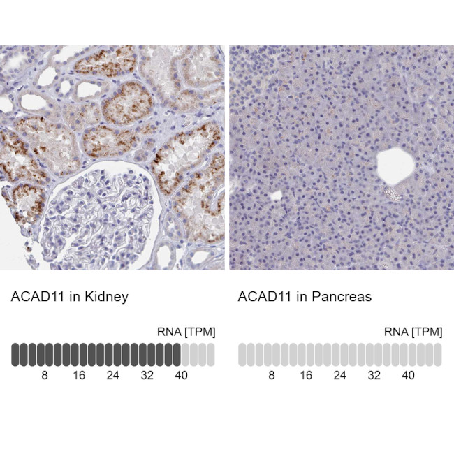 ACAD11 Antibody in Immunohistochemistry (IHC)
