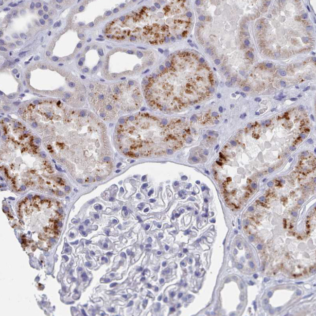 ACAD11 Antibody in Immunohistochemistry (IHC)