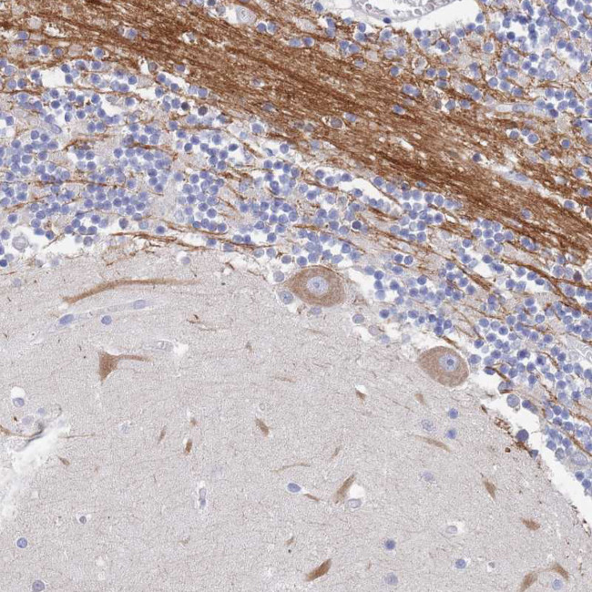 ACAD11 Antibody in Immunohistochemistry (IHC)