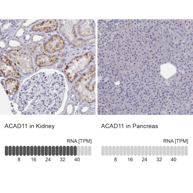 ACAD11 Antibody