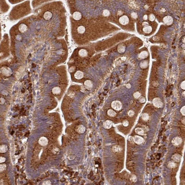 EDEM2 Antibody in Immunohistochemistry (IHC)