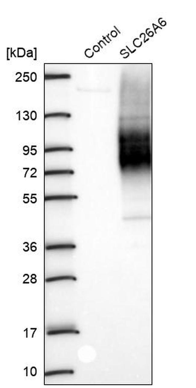 SLC26A6 Antibody in Western Blot (WB)