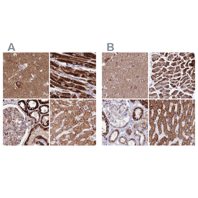 ATP5H Antibody in Immunohistochemistry (IHC)