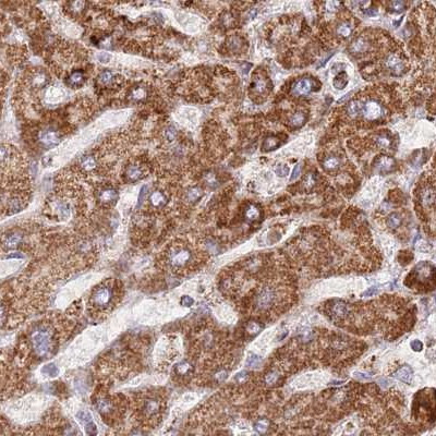 ATP5H Antibody in Immunohistochemistry (IHC)