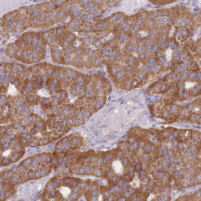 MRPS9 Antibody in Immunohistochemistry (IHC)