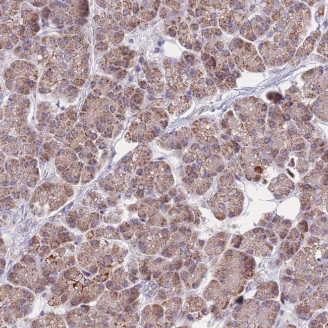 MRPS9 Antibody in Immunohistochemistry (IHC)