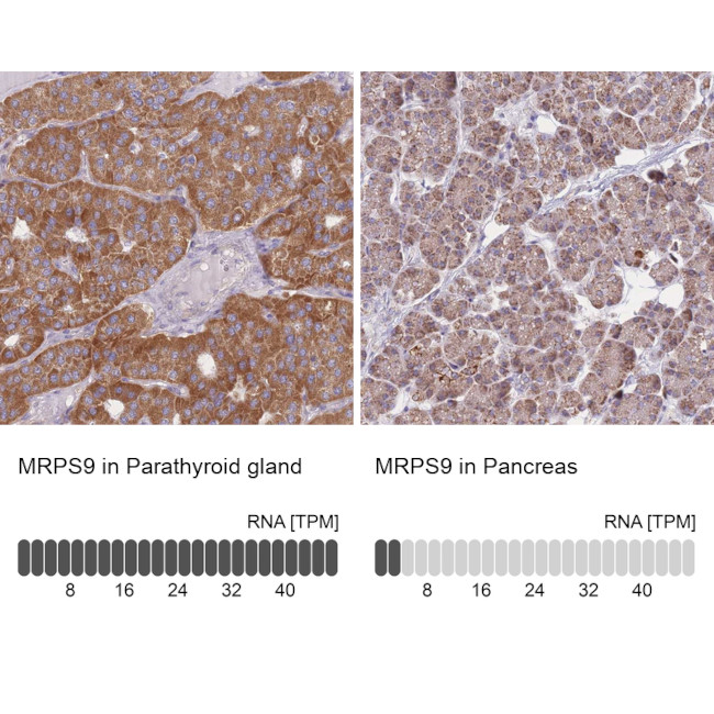 MRPS9 Antibody