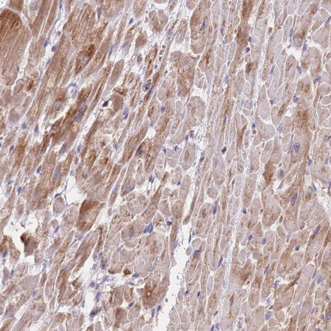 MRPS9 Antibody in Immunohistochemistry (IHC)