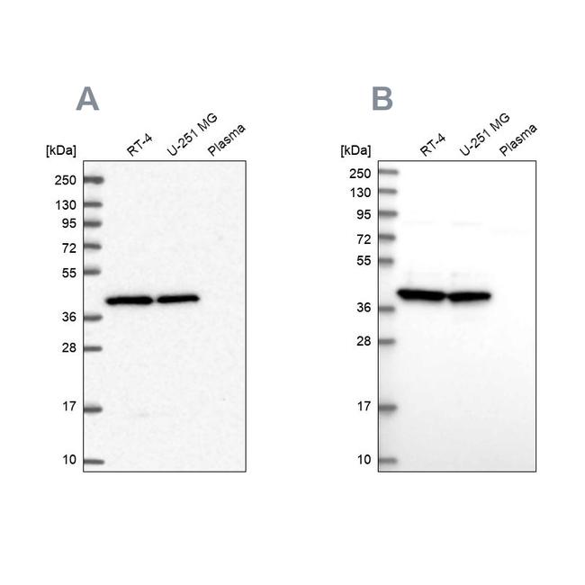 MRPS9 Antibody in Western Blot (WB)