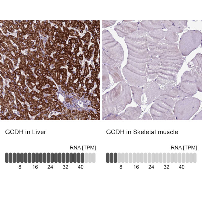 GCDH Antibody in Immunohistochemistry (IHC)