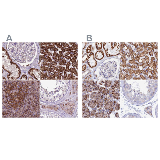 GCDH Antibody in Immunohistochemistry (IHC)