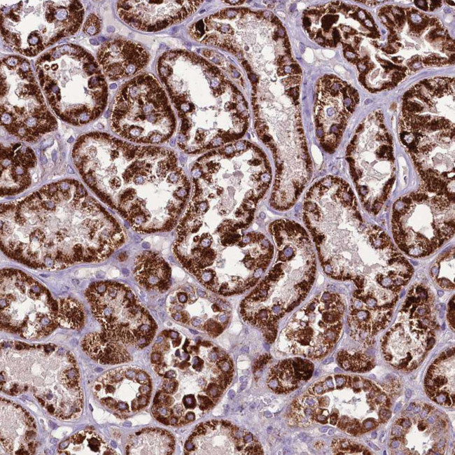 GCDH Antibody in Immunohistochemistry (IHC)