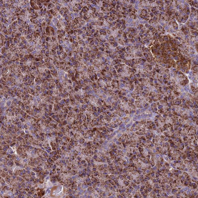 GCDH Antibody in Immunohistochemistry (IHC)