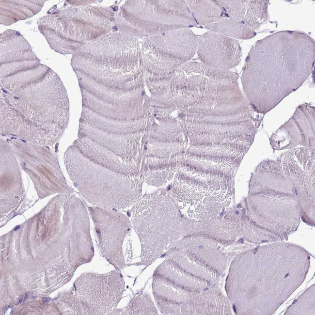 GCDH Antibody in Immunohistochemistry (IHC)