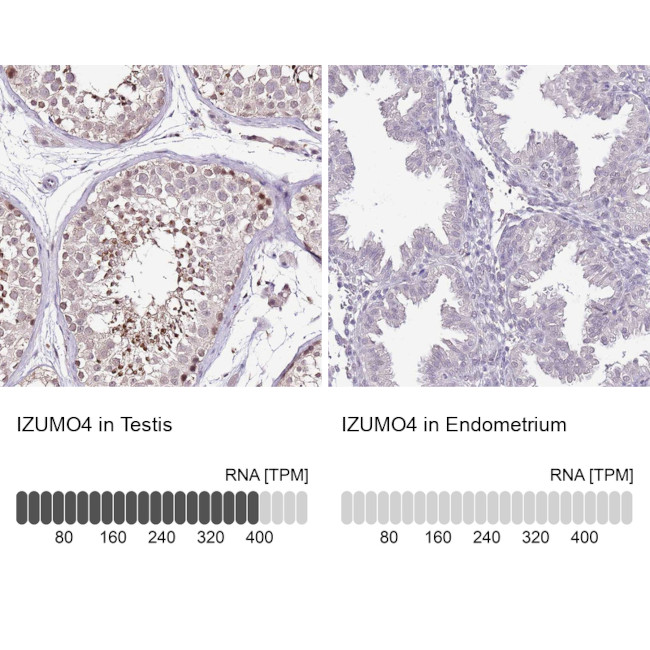 IZUMO4 Antibody in Immunohistochemistry (IHC)